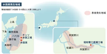 水俣病と水銀について